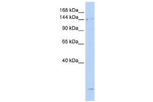 SMC4 antibody used at 1 ug/ml to detect target protein. (SMC4 anticorps  (N-Term))