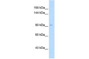 WB Suggested Anti-NEDD9 Antibody Titration:  5. (NEDD9 anticorps  (Middle Region))