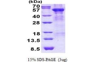 SDS-PAGE (SDS) image for Arylsulfatase A (ARSA) (AA 21-509) protein (His tag) (ABIN5852963)