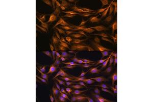 Immunofluorescence analysis of C6 cells using SO Rabbit pAb (ABIN6129624, ABIN6148259, ABIN6148260 and ABIN6221917) at dilution of 1:100.