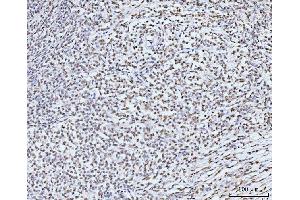 IHC analysis of KIFC1 using anti-KIFC1 antibody (ABIN7599523). (KIFC1 anticorps  (AA 1-673))