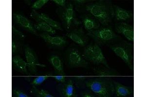 Immunofluorescence analysis of U-2 OS cells using NDUFB4 Polyclonal Antibody at dilution of 1:100 (40x lens). (NDUFB4 anticorps)