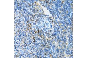Immunohistochemistry of paraffin-embedded mouse spleen using UBE2D1 antibody (ABIN3015751, ABIN3015752, ABIN3015753 and ABIN6219101) at dilution of 1:100 (40x lens). (UBE2D1 anticorps  (AA 1-147))