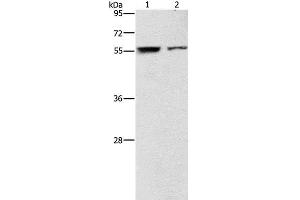 Western Blot analysis of Jurkat and 293T cell using ARHGAP15 Polyclonal Antibody at dilution of 1:500 (ARHGAP15 anticorps)