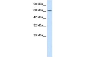 Western Blotting (WB) image for anti-Kelch-Like 28 (KLHL28) antibody (ABIN2460991) (KLHL28 anticorps)