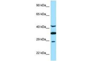 Image no. 1 for anti-Torsin Family 1, Member A (Torsin A) (TOR1A) (AA 201-250) antibody (ABIN6748405)