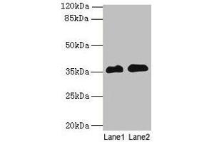 Western blot All lanes: RFPL3 antibody at 8 μg/mL Lane 1: Human placenta tissue Lane 2: HL60 whole cell lysate Secondary Goat polyclonal to rabbit IgG at 1/10000 dilution Predicted band size: 36, 33 kDa Observed band size: 36 kDa (RFPL3 anticorps  (AA 8-288))
