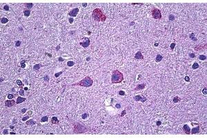 anti-Prokineticin Receptor 2 (PROKR2) (Internal Region) antibody