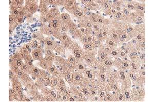 Immunohistochemical staining of paraffin-embedded Human liver tissue using anti-PRPSAP2 mouse monoclonal antibody. (PRPSAP2 anticorps)