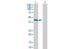 Lane 1: CTH transfected lysate ( 44. (CTH 293T Cell Transient Overexpression Lysate(Denatured))