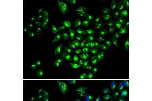 Immunofluorescence analysis of MCF-7 cells using RUNX1 Polyclonal Antibody