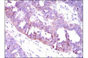 Immunohistochemistry (IHC) image for anti-Calcium/calmodulin-Dependent Protein Kinase IV (CAMK4) (AA 35-292) antibody (ABIN1845379)