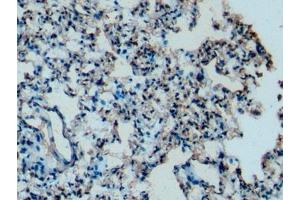 Detection of APOC1 in Mouse Lung Tissue using Monoclonal Antibody to Apolipoprotein C1 (APOC1)