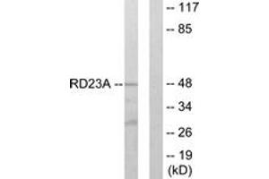 Western blot analysis of extracts from LOVO cells, using RAD23A Antibody. (RAD23A anticorps  (AA 91-140))