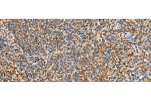 Immunohistochemistry of paraffin-embedded Human tonsil tissue using STK32C Polyclonal Antibody at dilution of 1:40(x200)