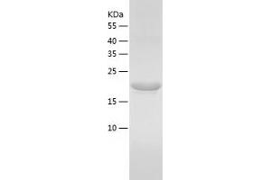 Western Blotting (WB) image for Interleukin 6 (IL6) (AA 25-211) protein (His tag) (ABIN7123611) (IL-6 Protein (AA 25-211) (His tag))