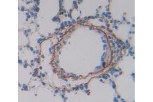 IHC-P analysis of Rat Tissue, with DAB staining. (Tissue factor anticorps  (AA 30-252))