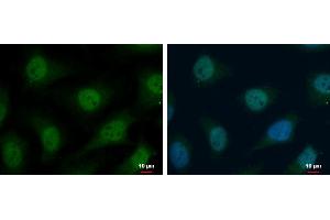 ICC/IF Image TrxR1 antibody detects TrxR1 protein at cytoplasm and nucleus by immunofluorescent analysis. (TXNRD1 anticorps)