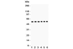 Western blot testing of CD8 antibody and Lane 1:  Jurkat