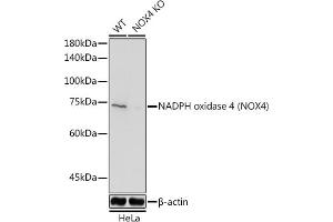 Western blot analysis of extracts from normal (control) and NADPH oxidase 4 (NOX4) Rabbit pAb knockout (KO) HeLa cells, using NADPH oxidase 4 (NOX4) Rabbit pAb antibody (ABIN6128328, ABIN6144752, ABIN6144753 and ABIN6215143) at 1:1000 dilution. (NADPH Oxidase 4 anticorps  (AA 328-578))