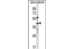 Western blot analysis in MDA-MB435 cell line lysates (35ug/lane). (OR8K1 anticorps  (C-Term))