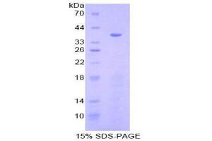 SDS-PAGE (SDS) image for Ezrin (EZR) (AA 1-295) protein (His tag) (ABIN1879042)