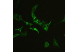 IHC analysis of CD147/Emmprin using anti-CD147/Emmprin antibody .