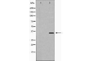 Western blot analysis of extracts of Jurkat using NUDT6 Antibody. (NUDT6 anticorps  (Internal Region))