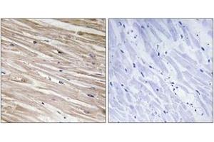 Immunohistochemistry analysis of paraffin-embedded human heart, using PEA-15 (Phospho-Ser104) Antibody.