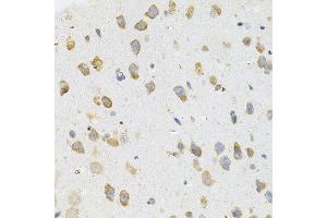 Immunohistochemistry of paraffin-embedded mouse brain using TGM2 antibody. (Transglutaminase 2 anticorps)