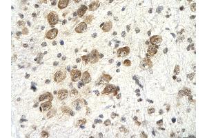 Rabbit Anti-PSMD4 Antibody       Paraffin Embedded Tissue:  Human neural cell   Cellular Data:  Epithelial cells of renal tubule  Antibody Concentration:   4.