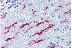 Human Brain, Cerebellum (formalin-fixed, paraffin-embedded) stained with ITGB2 antibody ABIN298664 at 10 ug/ml followed by biotinylated anti-mouse IgG secondary antibody ABIN481714, alkaline phosphatase-streptavidin and chromogen. (Integrin beta 2 anticorps)