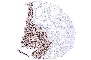 Urinary bladder with strong nuclear GATA3 positivity of all urothelial cells