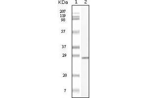 Western blot analysis using C-kit mouse mAb against truncated C-kit recombinant protein. (KIT anticorps)