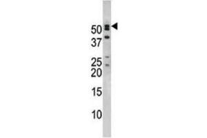 Western Blotting (WB) image for anti-Nucleoporin 50kDa (NUP50) antibody (ABIN2995223) (NUP50 anticorps)