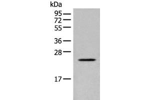 Western blot analysis of Human placenta tissue lysate using CARD16 Polyclonal Antibody at dilution of 1:800