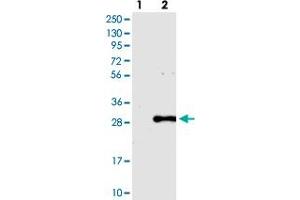 Western blot analysis of Lane 1: Negative control (vector only transfected HEK293T lysate), Lane 2: Over-expression Lysate (Co-expressed with a C-terminal myc-DDK tag (~3. (PCNP anticorps)
