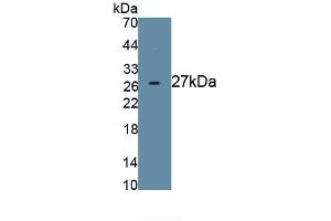 Detection of Recombinant NPHN, Human using Monoclonal Antibody to Nephrin (NPHN)