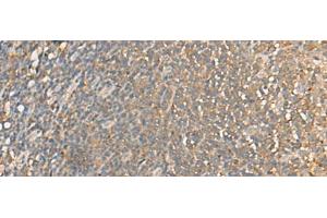 Immunohistochemistry of paraffin-embedded Human tonsil tissue using DGLUCY Polyclonal Antibody at dilution of 1:40(x200) (C14ORF159 anticorps)