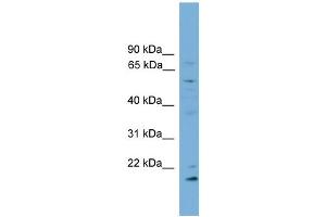 WB Suggested Anti-CYP2R1 Antibody Titration:  0.