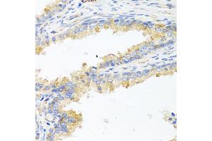 Immunohistochemistry of paraffin-embedded human prostate using ApoE antibody. (APOE anticorps)