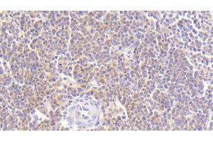 Detection of MDC in Human Spleen Tissue using Polyclonal Antibody to Macrophage Derived Chemokine (MDC) (CCL22 anticorps  (AA 25-93))