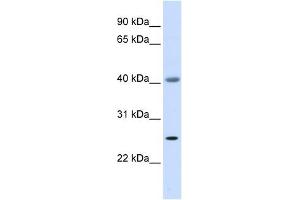 ADA antibody used at 1 ug/ml to detect target protein.