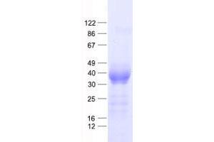 Validation with Western Blot