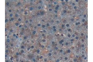 Detection of CD55 in Human Liver Tissue using Polyclonal Antibody to Cluster Of Differentiation 55 (CD55)