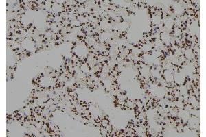 ABIN6279634 at 1/100 staining Rat lung tissue by IHC-P. (ZCCHC17 anticorps  (Internal Region))
