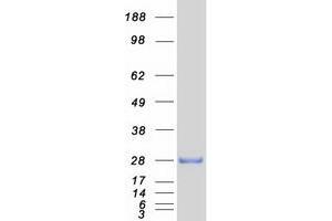 Validation with Western Blot