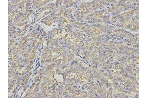 Immunohistochemistry (IHC) image for anti-Proteasome (Prosome, Macropain) 26S Subunit, Non-ATPase, 7 (PSMD7) antibody (ABIN1876544) (PSMD7 anticorps)