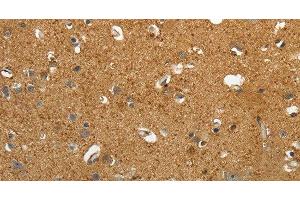 Immunohistochemistry of paraffin-embedded Human brain tissue using AKAP12 Polyclonal Antibody at dilution 1:40