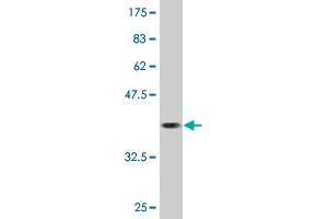 Western Blot detection against Immunogen (36. (CAMKK1 anticorps  (AA 2-100))